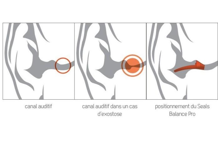 EQ ear plugs bouchons d'oreilles